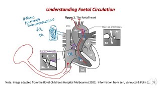 Preductal pulse oximetry  why does the probe always go on a newborns right hand [upl. by Soisinoid]