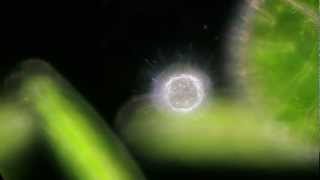 Heliozoon Acanthocystis turfacea [upl. by Ecyak484]