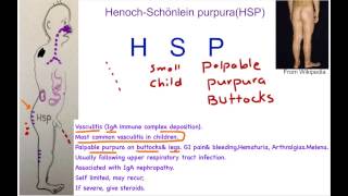 HenochSchönlein Purpura Mnemonic [upl. by Jasun]