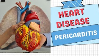 Pericarditis Disorders Types Symptoms Causes and Treatments Explained [upl. by Oralee]