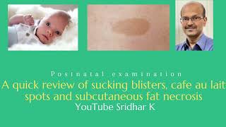 Sucking blisters cafe au lait spots and subcutaneous fat necrosis Dr Sridhar K [upl. by Adamo]