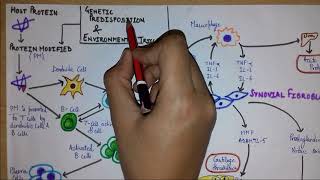 What is rheumatoid arthritis Part 1  Introduction Etiology Pathogenesis [upl. by Etnaik]