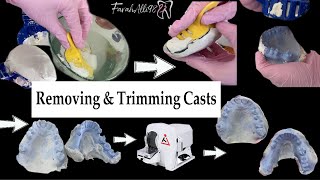 Cast separation Remove  from Alginate impression Trimming Diagnostic Casts how to remove the cast [upl. by Meadow]