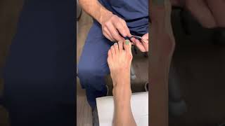 Corrective Bunion Taping [upl. by Michail]