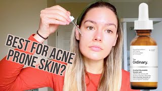 Best Vitamin C serum for Sensitive Acne Prone Skin The Ordinary Ascorbyl Glucoside 12 review [upl. by Ivie2]