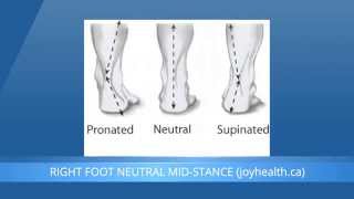 Foot Pronation And Supination  What Is The Difference [upl. by Napoleon]