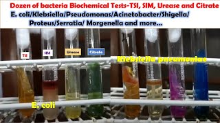 Various Bacteria Biochemical Tests E coli KlebsiellaPseudomonasAcinetobacterProteusMongenella [upl. by Hoxie]