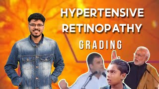 Hypertensive Retinopathy Grading  Ophthalmology  Retinal Disorders  NEETPG  INICET  FMGE [upl. by Ten]