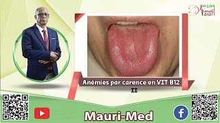 Hématologie  Carence en vitamine B12  Manifestations cliniques [upl. by Auof]