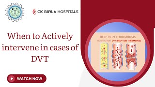 When to Actively intervene in cases of DVT  Deep Vein Thrombosis [upl. by Clyte420]