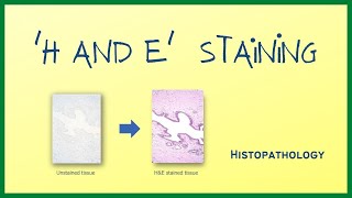 H amp E Staining  Hematoxylin and Eosin stain  Histopathology  Hindi [upl. by Marienthal]