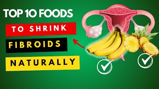 Top 10 foods to shrink fibroids naturally and fast [upl. by Dijam802]