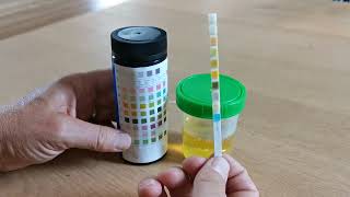 How to use urine test strips 10 parameters [upl. by Ettevi555]