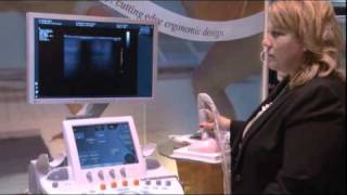 Hologic  Breast Ultrasound MRI and Tomosynthesis [upl. by Rovaert307]