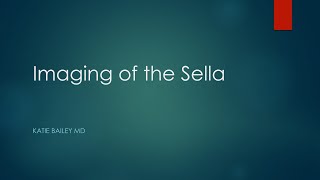 Imaging of the sella [upl. by Halima]