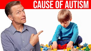 The REAL Cause of Autism Revealed Dr Berg Explains [upl. by Stanislaus623]