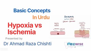 Hypoxia vs Ischemia [upl. by Gabie471]