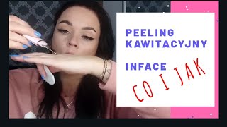 PEELING KAWITACYJNY InFace  test recenzja jak używać [upl. by Carol265]