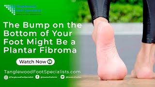 The Bump on the Bottom of Your Foot Might Be a Plantar Fibroma [upl. by Jacinto]