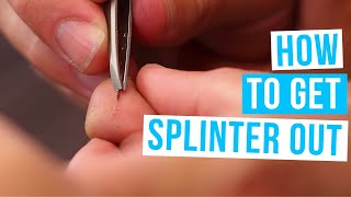 How to GET A SPLINTER OUT  Get rid of splinters with or without tweezers [upl. by Ahsei]