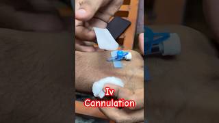 Iv cannulation  cannula doctor baby ivcannulation SMpharmacy subscribe [upl. by Dnalram]