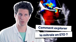 Comment explorer la mitrale en ETO [upl. by Colier]