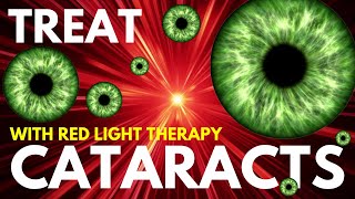 Red Light Therapy Improves Cataracts and Age Related Macular Degeneration [upl. by Bilac]