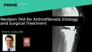 Revision TKA for Arthrofibrosis Etiology and Surgical Treatment  Peter K Sculco MD [upl. by Frederigo]