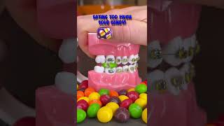 WORST HABITS FOR YOUR TEETH 🦷DONT DO THIS WITH BRACES 👀 ORTHODONTIST REACTS ASMR CRUNCHY [upl. by Euqinehs]