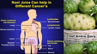 Drink Noni Juice And Never Get Sick Again  Natural Noni Juice  Noni Juice Health Benefits [upl. by Trinatte]