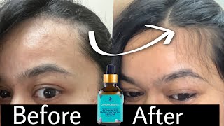 Pilgrim HAIR GROWTH SERUM Review after Using 30 days  quotबालों को झड़ने से रोकने के लिए सीरमquot [upl. by Audi]