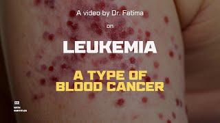 LEUKEMIA Causes Signs and Symptoms Diagnosis and Treatment [upl. by Karlens]