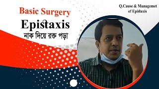 Epistaxis lecture surgery bengali । নাক দিয়ে রক্ত পড়া । Epistaxis Definecause amp management [upl. by Nirroc]