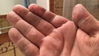 How to REALLY Remove Sticky Crazy Glue or Spray Foam Adhesive Chemicals from your hands [upl. by Kciregor832]