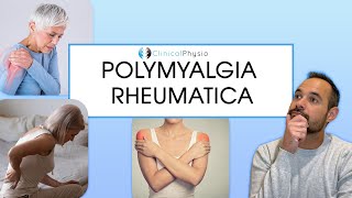 Polymyalgia Rheumatica  Signs and Symptoms of PMR [upl. by Layney]