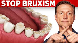 The Best 2 Remedies for Teeth Grinding Bruxism [upl. by Aleakim53]