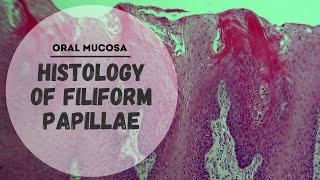 Histology of Specialized Mucosa  Filiform papillae [upl. by Atilam]