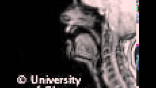 MRI voiced postalveolar fricative [upl. by Older]