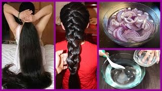 How to Grow Long Thicken Hair with Onion  Worlds Best Remedy for Hair Growth [upl. by Rouvin]