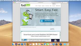 RadiAnt DICOM Viewer on macOS Mojave [upl. by Bertha]