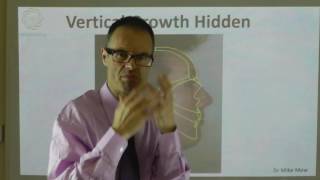 Hiding An Increase in Vertical Facial Growth By Dr Mike Mew [upl. by Nortad]