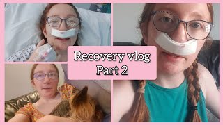 Cleft Septoplasty Recovery Part 2 [upl. by Kynan]