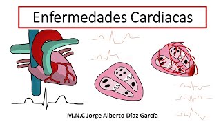 Enfermedades Cardiacas [upl. by Tsenrae677]