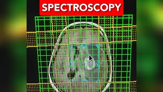 Brain Spectroscopy Planing [upl. by Ruthann]