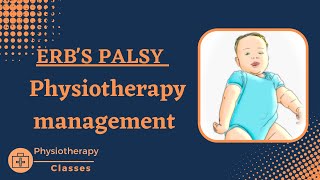 Erbs palsy physiotherapy managementphysical therapy for erbs palsyerbs paralysispt management [upl. by Iand189]