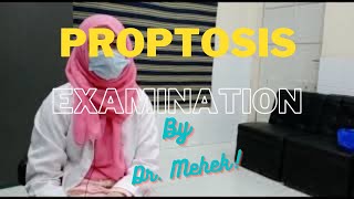 Proptosis Examination [upl. by Soraya]