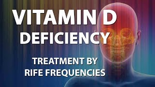 Vitamin D Deficiency  RIFE Frequencies Treatment  Energy amp Quantum Medicine with Bioresonance [upl. by Barstow995]