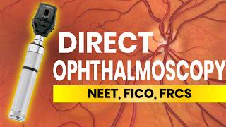 Direct Ophthalmoscopy Tips and Tricks [upl. by Swann]