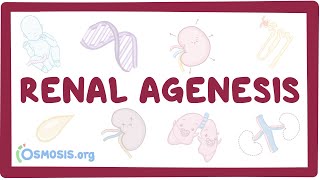 Renal agenesis unilateral bilateral oligohydramnios  causes symptoms amp pathology [upl. by Khanna]