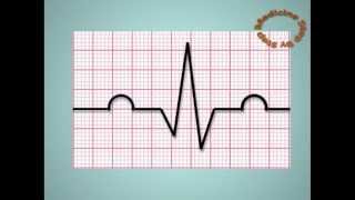 Understanding ECGs  EKG [upl. by Alrad]